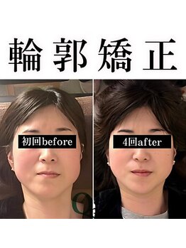 キュープ 鹿児島伊集院店(Qpu)/