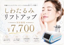 ティンク(Tink)