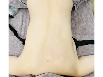 シアンドットアンド(cyan.&)/リンパマッサージ右側施術後