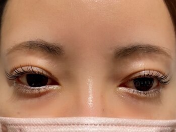 アンネ 東心斎橋店(ANNE)/モンテラッシュリフト