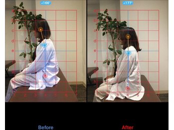 ケアハウス センター南(CARE HOUSE)/施術効果写真☆(before after)