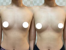 ハレオラ(HaleOla)/お客様の変化☆バストケア