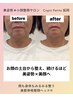 リピート率90%以上！！みるみる整う小顔整顔