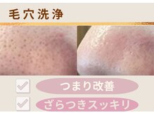 【一度で変わる】毛穴悩みがある方におすすめ◎↑