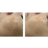 ラメール(La_mer)