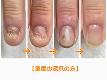 レアム/指先に力が入らない。