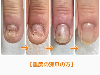 レアム/指先に力が入らない。