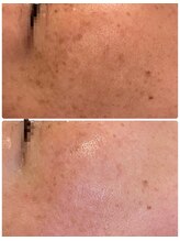 ソリシア(SORISIA)/