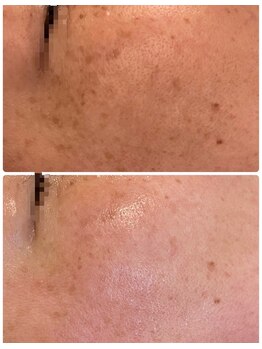 ソリシア(SORISIA)/