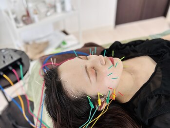 フラット(flat)/美容鍼で小顔・むくみケア
