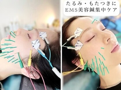 アオヤマ サロン ワイゼット(AOYAMA SALON YZ)の写真