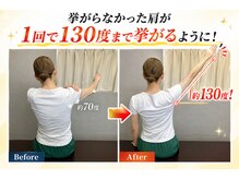 浦和ふくろうSUN整体院の雰囲気（右肩の痛みが1回の施術でここまで挙がるようになりました！）