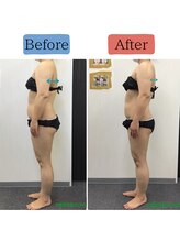 ステイゴールド美容整体院(STAY GOLD)/猫背矯正＋ハイパーナイフ