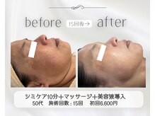 アリス 心斎橋店(alice)/マッサージ付きシミケア10分