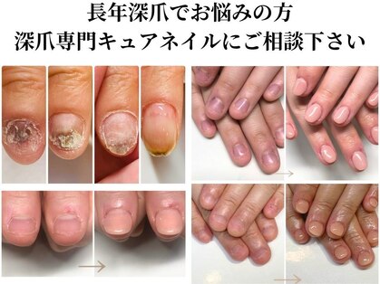 キュアネイル(Qa Nail)の写真