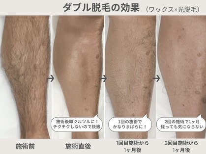 クリード(CLEAD)の写真