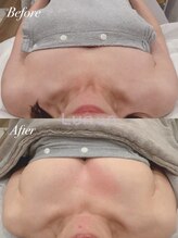 ルノン(Lunon)/【50代・ハリ＆弾力】バストケア