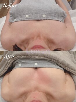 ルノン(Lunon)/【50代・ハリ＆弾力】バストケア