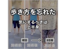 カワル整体 上通り院/歩行：見るべきは上半身