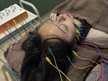 アオイ(aoi)/美容鍼