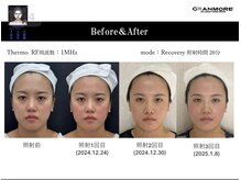 ルタン リッシュ(Le temps Riche)の雰囲気（持続する最新小顔コースできゅっと引きあげ引き締め目元ぱっちり）