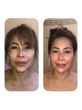 ビユー エスティカ オリエンタル 伊勢崎店(BIYU ESTETICA ORIENTAL)/ララピル