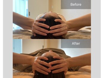 シュシュ(Chou chou)/【Before★After】ヘッドスパ