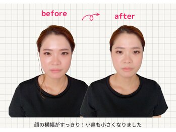 ナチュラルハリー(NaturalHarry)/当サロン自慢の経絡小顔施術!