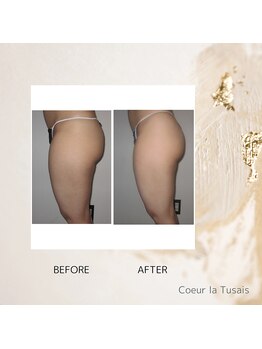 クーラ テュセ(Coeur la Tusais)/下半身集中痩身
