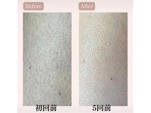 リードエピア(LEADepiA)/50代の肌も変われます！！