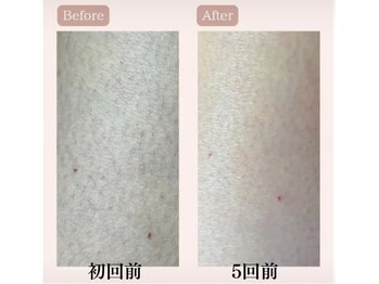 リードエピア(LEADepiA)/50代の肌も変われます！！