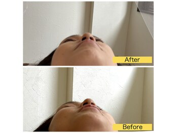 ルク ソル(Luxsol)/お顔のゆがみ　小顔矯正