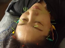 体調律整体部門ぷにぷに