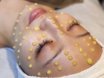 シャラ(shara)の写真/【矯正】【整体】【コルギ】の組み合わせ＆【マイクロニードル】でもたつくフェイスラインを改善☆