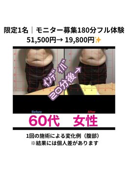 サクランボ(SAKURAMBO)/画像提供等　モニター募集