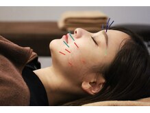小林整骨院 本町の雰囲気（【リフトアップ美容鍼】）