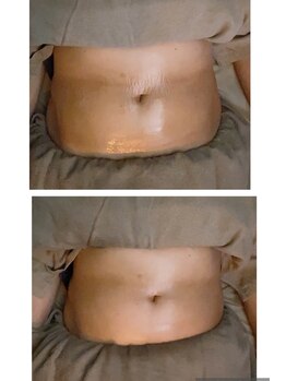 ヴァローレ(valore)/腸の働きを整えます！