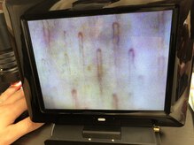 仁接骨院 じん鍼灸治療院/これぞ血管美人！