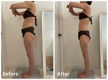 ナビ(NABI)/腹筋強化で反り腰改善