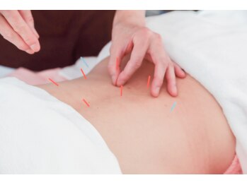 美容鍼灸salonまつもと/