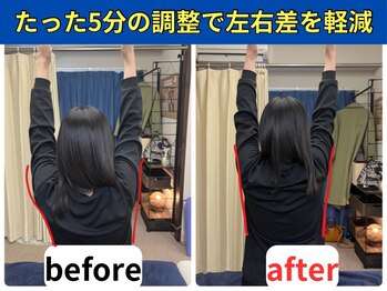 リポール 目黒(Re pol)/BeforeAfter 頚椎矯正