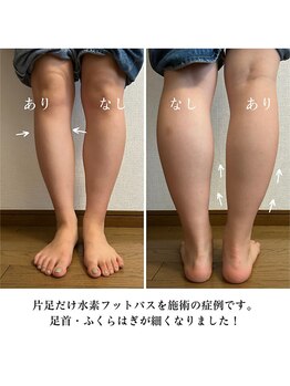 ヨサパーク リリアン 西小山(YOSA PARK Lillian)/水素フットバスがむくみに効く！