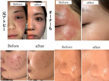 ソナミオール(SonaMior)