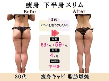 グレースエール トータルビューティーサロン(Grace Aile)/痩身【下半身スリム】