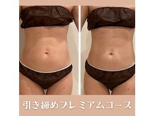 短期集中がお勧め！卒業のあるエステYOSAPARK