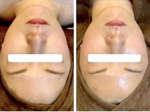 香嬉琉/学割・UR24 初めての肌育