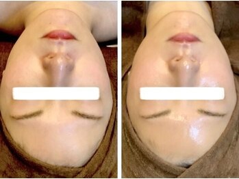 香嬉琉/学割・UR24 初めての肌育