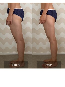 トリムリターン 三重伊賀店Mana/むくみ解消、脚スッキリ軽快に