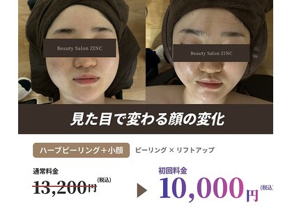 ジンク(ZINC)の写真