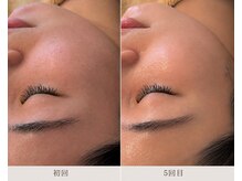 リッシュ 骨盤革命(RICHE.)/牛込神楽坂/韓国肌管理/美容整体